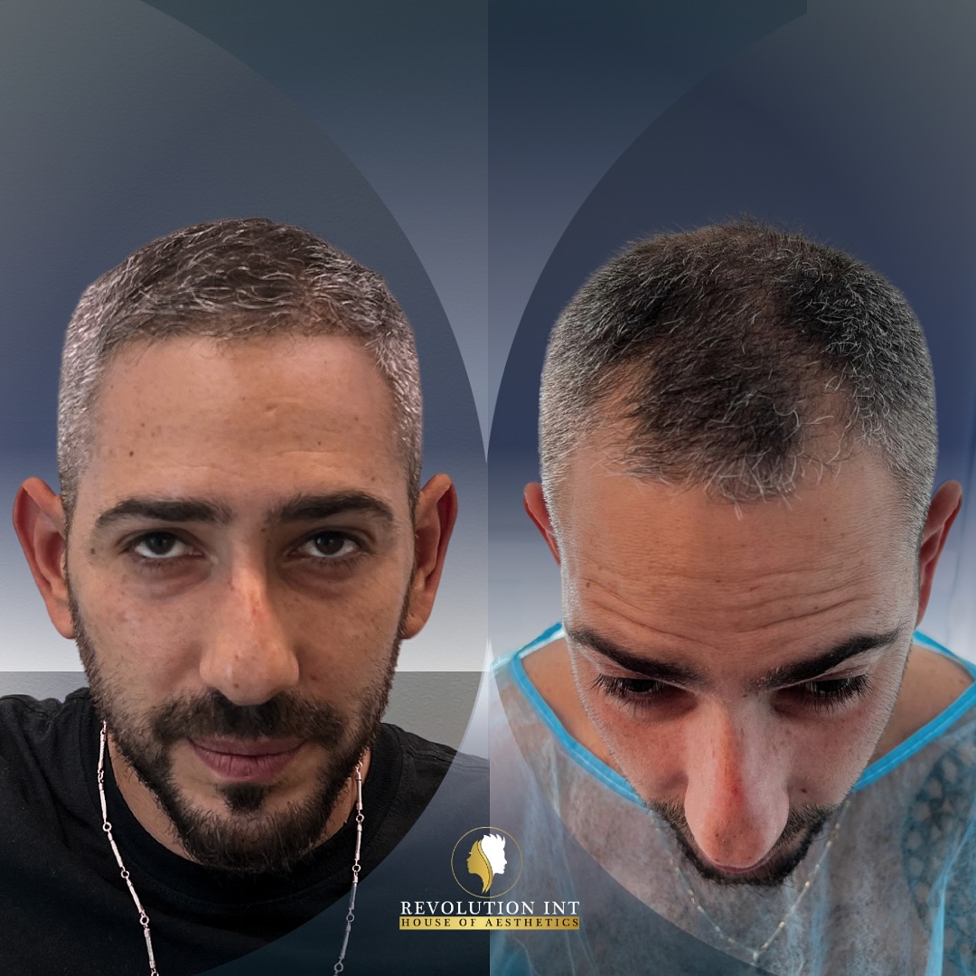 אושרי