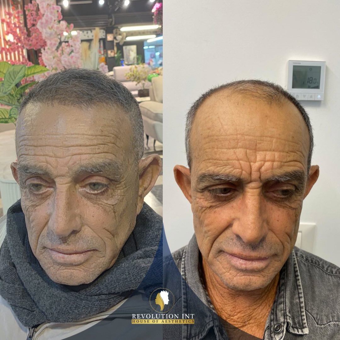 רמי
